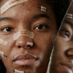 Zbliżenie młodej kobiety z trądzikiem i hasłami o akceptacji siebie